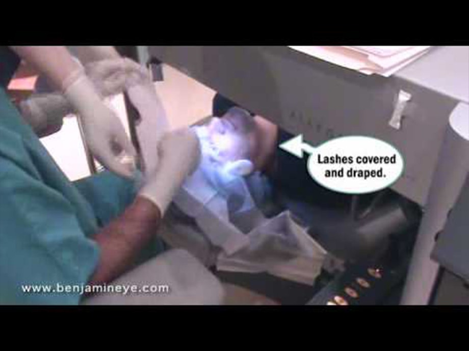 Dr. Benjamin's Lasik Experience